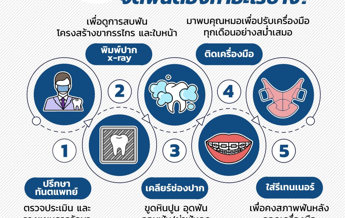 5 ขั้นตอน จัดฟันต้องทำอะไรบ้าง?