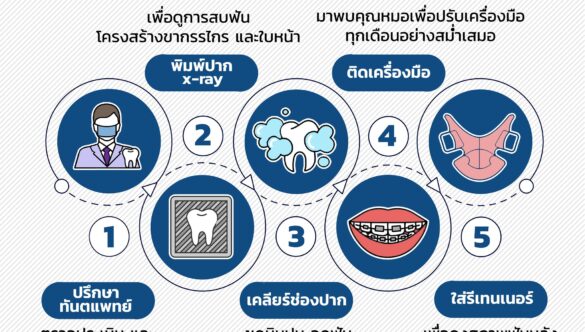 5 ขั้นตอน จัดฟันต้องทำอะไรบ้าง?