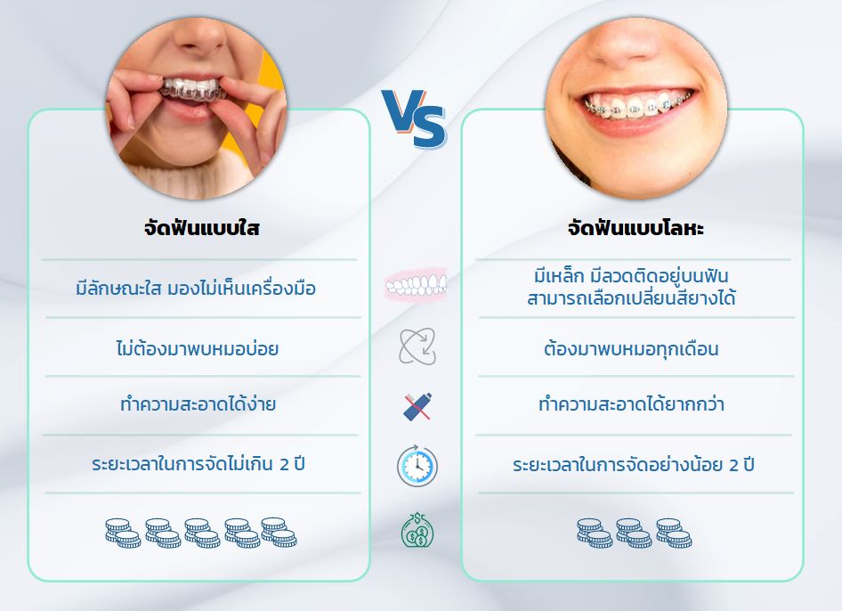 เปรียบเทียบจัดฟันในเว็ป