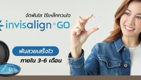 มาความรู้จัก Invisalign<sup>®</sup> Go