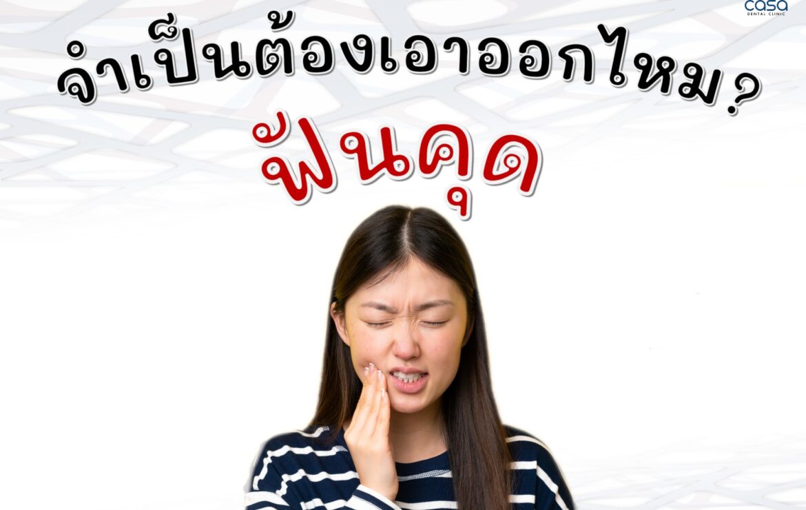 ฟันคุด จำเป็นต้องเอาออกไหม?