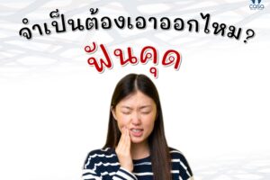 ฟันคุด จำเป็นต้องเอาออกไหม?