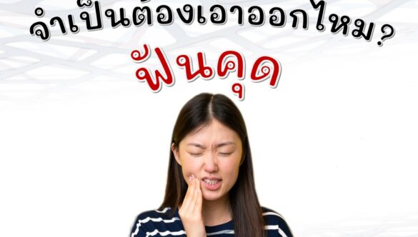 ฟันคุด จำเป็นต้องเอาออกไหม?