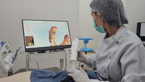 3D Dental Scan with iTero: Fast