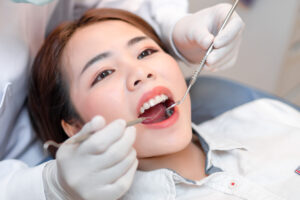 Dental Scaling & Tartar Removal
