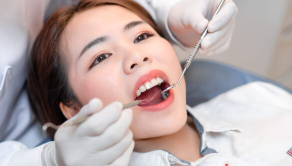Dental Scaling & Tartar Removal