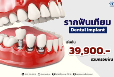 รากฟันเทียม