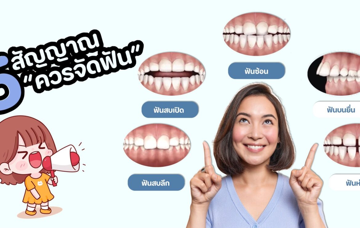 5 สัญญาณที่บอกว่า “คุณควรจัดฟัน”