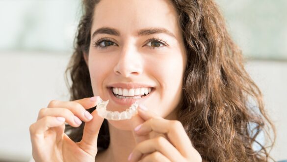 What are Vivera Retainers by Invisalign?