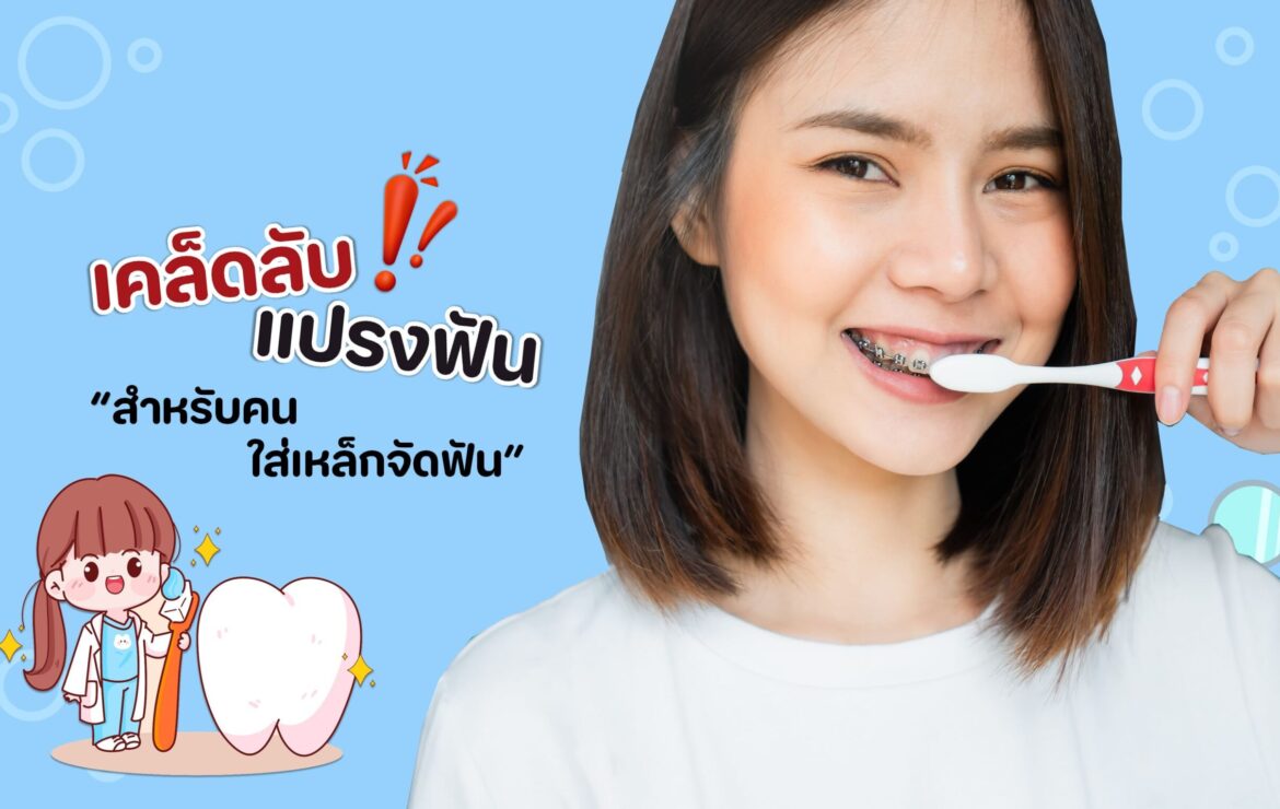 เคล็ดลับแปรงฟันสำหรับคนใส่เหล็กจัดฟัน !!