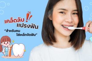 เคล็ดลับแปรงฟันสำหรับคนใส่เหล็กจัดฟัน !!