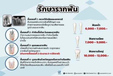 Root Canal Treatment