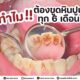 ทำไมต้องขูดหินปูนทุก 6 เดือน ?