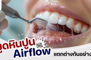 ขูดหินปูน vs Airflow แตกต่างกันอย่างไร ?