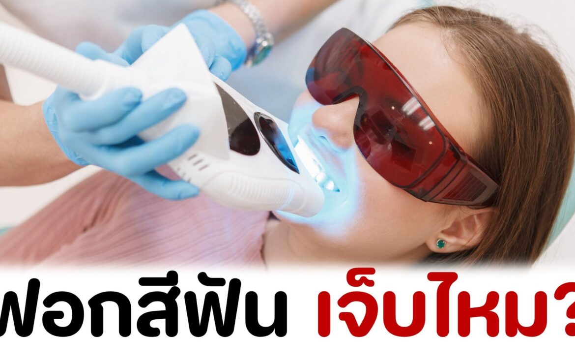 ฟอกสีฟัน เจ็บไหม?