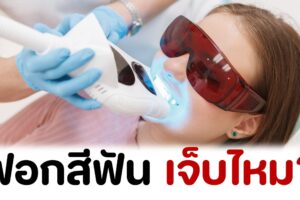 ฟอกสีฟัน เจ็บไหม?