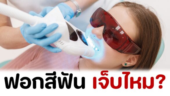 ฟอกสีฟัน เจ็บไหม?