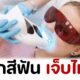 ฟอกสีฟัน เจ็บไหม?