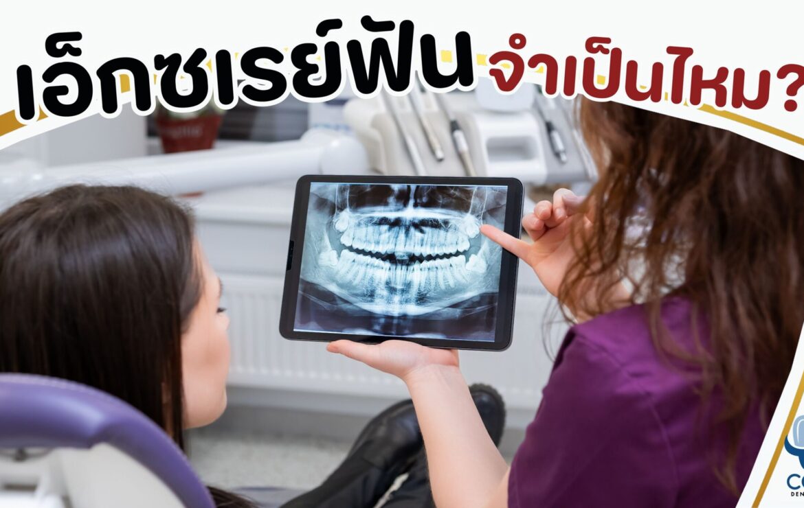 เอ็กซเรย์ฟัน จำเป็นไหม ?