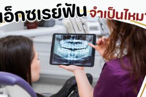 เอ็กซเรย์ฟัน จำเป็นไหม ?