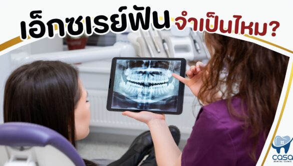 เอ็กซเรย์ฟัน จำเป็นไหม ?