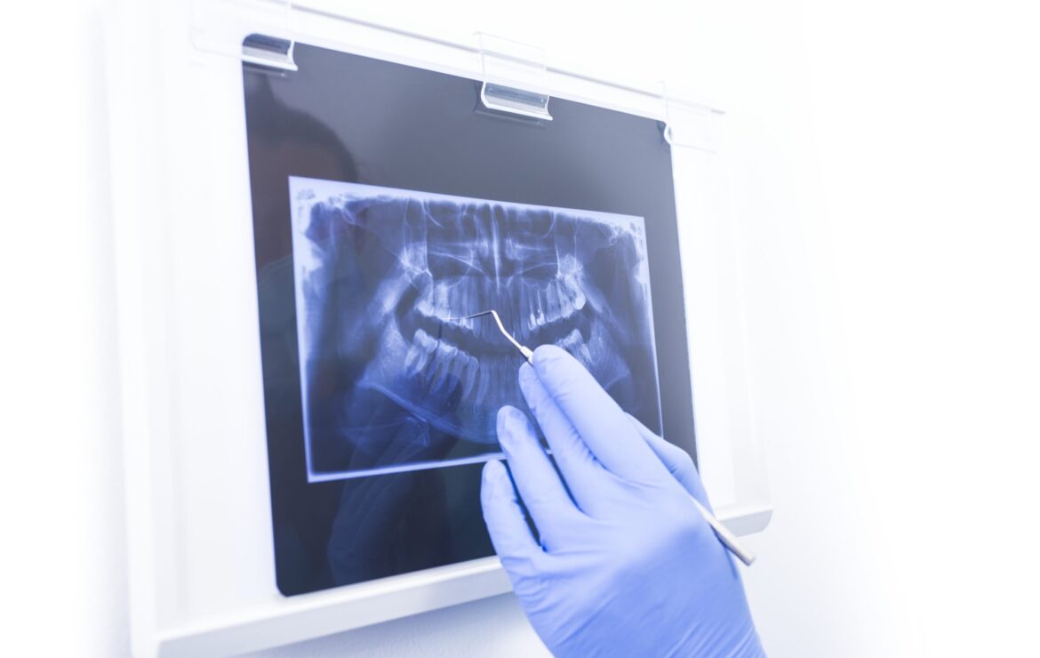 Dental X-ray Safety