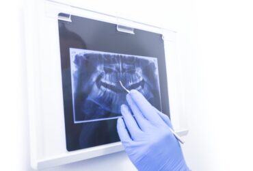 X-RAY 3D
