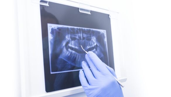 Dental X-ray Safety