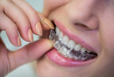 Metal Braces & Clear Aligners