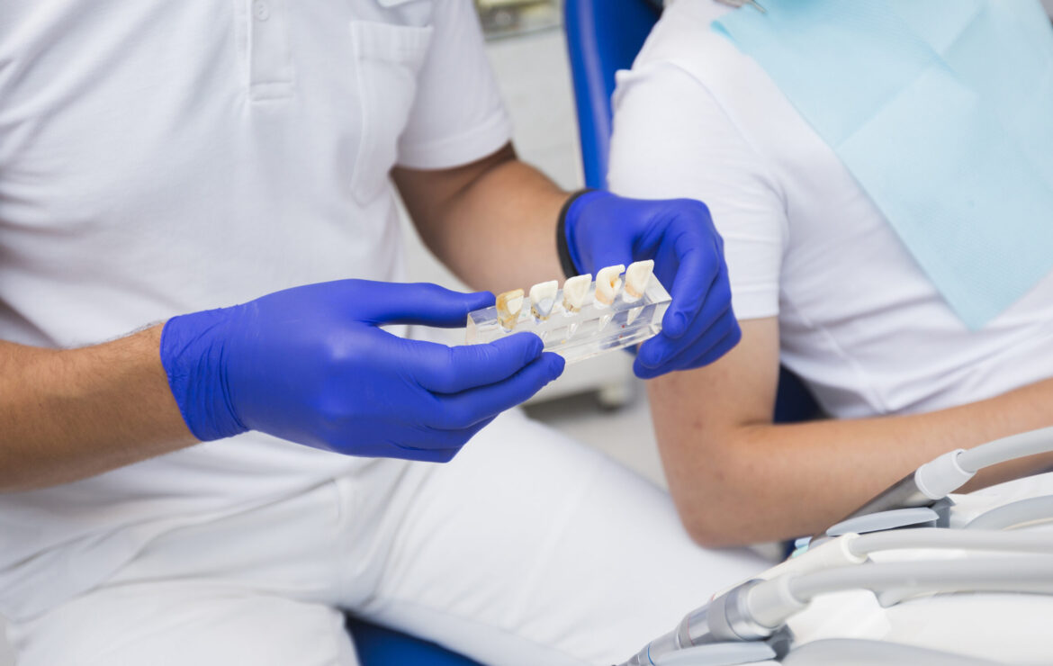 Dental Veneers