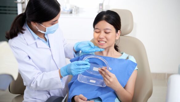 Dental Filling Surfaces Explained