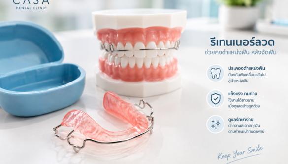 ทำไมต้องใส่รีเทนเนอร์หลังจัดฟัน ? รีเทนเนอร์สำคัญอย่างไร ?